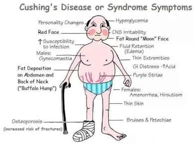 Bệnh nhân suy tuyến thượng thận cần biết