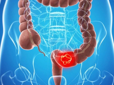 Ung thư đại trực tràng ở người cao tuổi: Nguyên nhân sinh bệnh và phương pháp điều trị