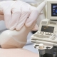 Siêu âm đàn hồi mô tuyến vú: Những thông tin cần biết