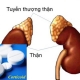 Suy thượng thận do thuốc Corticoid có thể chữa khỏi không?