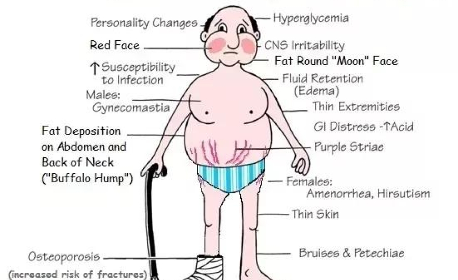 Bệnh nhân suy tuyến thượng thận cần biết